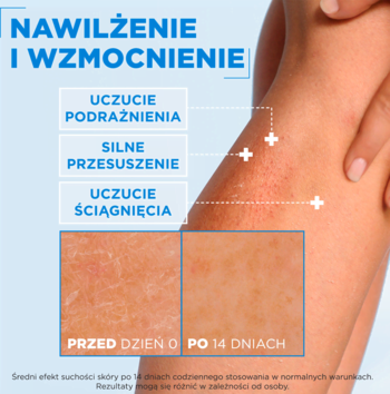 Noga z porównaniem skóry przed i po 14 dniach użycia kremu Mixa, widoczna redukcja podrażnień i przesuszenia.