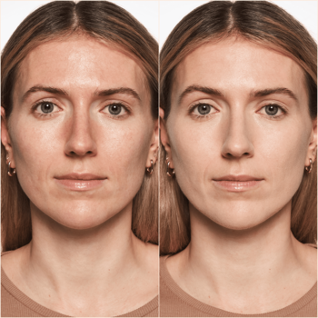 Kobieta przed i po aplikacji podkładu Catrice HD Liquid Coverage Ivory Beige, ukazując idealne krycie i matowe wykończenie.