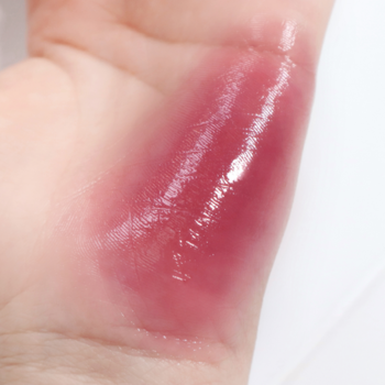 Zbliżenie na duży, błyszczący, czerwonawy pęcherz wypełniony płynem, widoczny na wewnętrznej stronie dłoni.