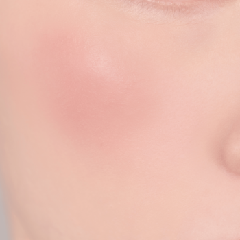 Bliskie ujęcie na skórę policzka z delikatnie nałożonym, matowym różem, nadającym naturalny, świeży rumieniec.