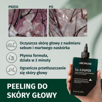 Peeling do skóry głowy AROMASE 5α JUNIPER, butelka, i porównanie skóry głowy przed/po użyciu. Opis PL.