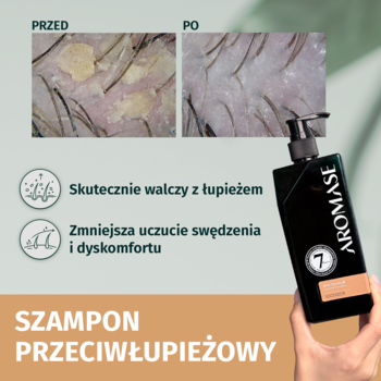 Szampon AROMASE przeciwłupieżowy, czarna butelka z pompką, obok zdjęć poprawy skóry głowy po użyciu.