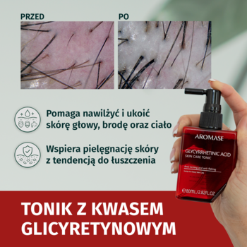 AROMASE Tonik z kwasem glicyretynowym, butelka z pompką w dłoni, przed/po łuszczącej się skóry głowy.