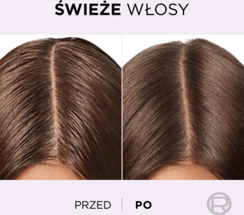 Porównanie skóry głowy przed i po użyciu Elseve Hyaluron Pure serum: odświeżone, mniej przetłuszczone włosy.