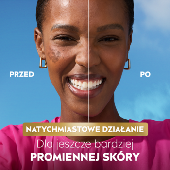 NIVEA LUMINOUS630 krem na przebarwienia. Kobieta przed i po: z redukcją ciemnych plam, rozświetlona cera.