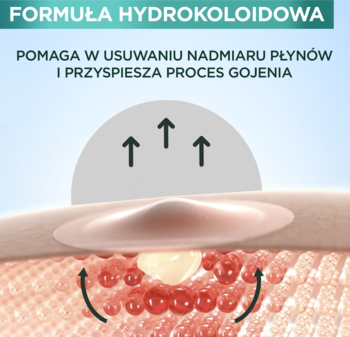 Diagram: plaster hydrokoloidowy Garnier wchłaniający płyn z wyprysku na skórze, z podpisem Formuła Hydrokoloidowa.