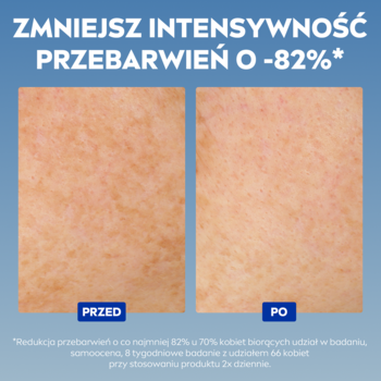 NIVEA Luminous630® Serum: Przed i po redukcji przebarwień o 82%. Dwa zdjęcia twarzy z widoczną poprawą.