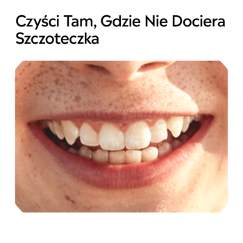 Zbliżenie na uśmiechnięte usta dziecka z zębami i piegami, pokazujące obszary do czyszczenia Listerine Smart Rinse.