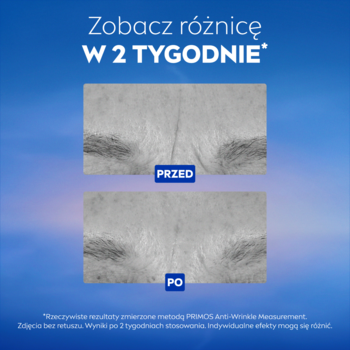NIVEA CELLULAR Epigenetics krem na noc: porównanie 'przed i po' redukcji zmarszczek czoła w 2 tyg.