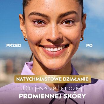 Kobieta: lewa strona twarzy 'przed', prawa 'po' użyciu NIVEA LUMINOUS630 Krem CC SPF 30, z promienną cerą.