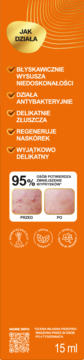 Pomarańczowa infografika: preparat punktowy "Różowy killer niedoskonałości" – zalety, efekty przed/po, 15 ml.