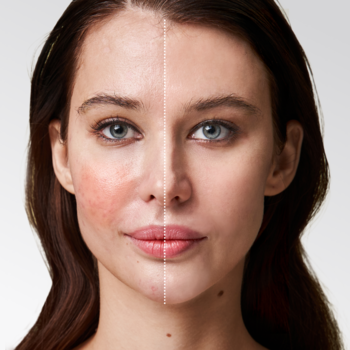 Krem CC AA LAAB 03 Beige przed/po. Kobieta: jedna strona twarzy z zaczerwienieniami, druga z wyrównanym kolorytem.