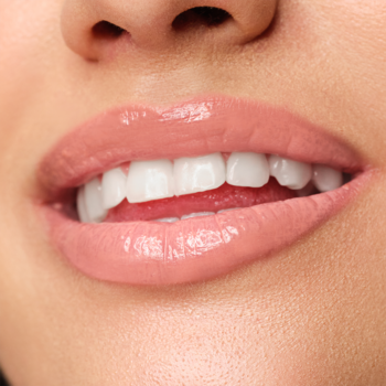 Zbliżenie na gładkie, pełne usta kobiety z błyszczykiem Artdeco Plumping Lip Fluid Glossy Nude, widoczne zęby.