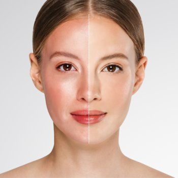 Kobieta z twarzą podzieloną: czerwona od słońca skóra i druga połowa z równym kolorytem. Krem BB AA LAAB Lumi-Glow SPF 30 Beige.