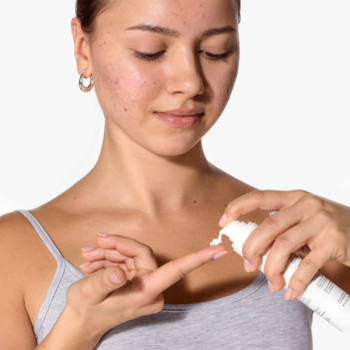 Młoda kobieta nakłada krem-żel na przebarwienia potrądzikowe z białej butelki z pompką.