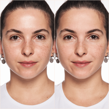 Przed i po: twarz kobiety, lewo z zaczerwienieniami, prawo matowa i wygładzona pudrem All Matt Plus.