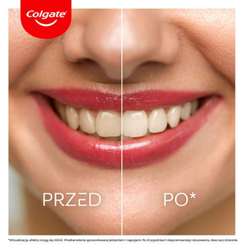 Colgate Max White Ultra, wybielanie. Uśmiechnięta kobieta, zęby przed (żółte) i po (białe), widoczny efekt.