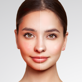 Podkład mineralny YOU.mmy Skin 02 Nude: efekt przed i po. Kobieta z zaczerwienioną skórą (lewa strona) i gładką, ujednoliconą (prawa).